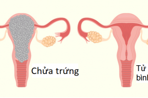 Chửa trứng có nguy hiểm không?